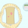 Upptäcka onormal blödning mellan menstruationer