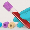 Ökad glomerulär filtreringshastighet
