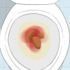 Att känna igen symtomen på tjocktarmscancer