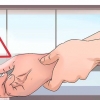 Behandling av giktattack