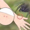 Identifiera ett spindelbett