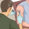 Ta bort en tatuering