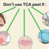 Applicera en tca peel