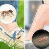 Känn igen insektsbett