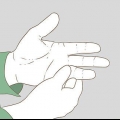 Bedömer om ett finger är brutet