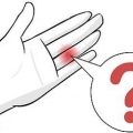 Behandla ett skadat finger