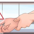 Behandling av giktattack