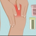 Behandling av tendinit i quadriceps