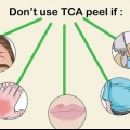 Applicera en tca peel