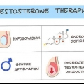 Att ge en testosteroninjektion