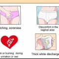 Behandling av en vaginal jästinfektion