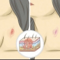 Ge en hickey