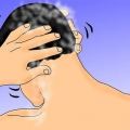 Använder rogaine eller minoxidil