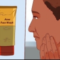 Bli av med en finne med aloe vera gel