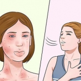Behandling av allergier
