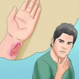Förhindra botulism