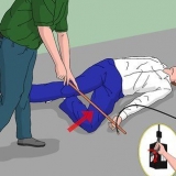Behandling av elektricitetsbrännskador