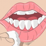 Cheilit exfoliativ botemedel