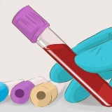 Ökad glomerulär filtreringshastighet
