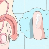 Att känna igen symptomen på klamydia (för män)