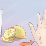 Ta bort ett keloidärr: kan det göras med receptfria medel?