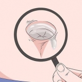 Behandla en inflammerad navel