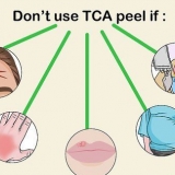 Applicera en tca peel