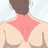 Återställa en trapezius-stam