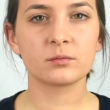 Applicera läppliner