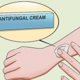Behandla ringorm