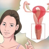 Diagnostisera vaginal flytning