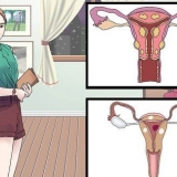 Behandling av vaginalcystor