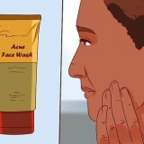 Bli av med en finne med aloe vera gel