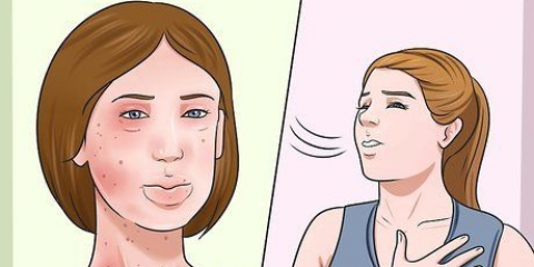 Behandling av allergier