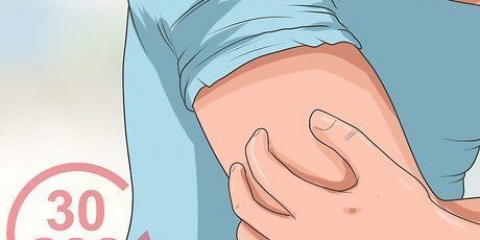 Behandling av karpaltunnelsyndrom med massagebehandling