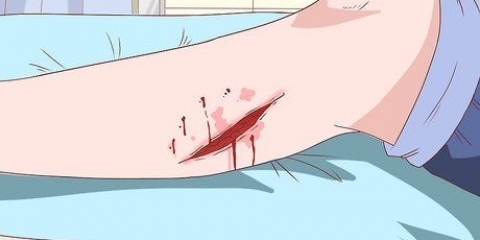 Behandling av celluliter