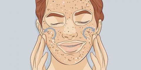 Exfoliera huden