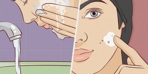 Ta hand om huden efter mikrodermabrasion