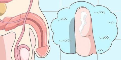 Att känna igen symptomen på klamydia (för män)