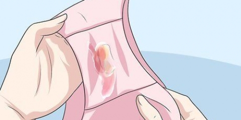 Att känna igen symptomen på klamydia (för kvinnor)