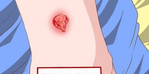 Att känna igen symptomen på en mrsa-infektion