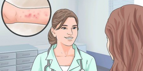 Lindrar symtomen på spongiotisk dermatit