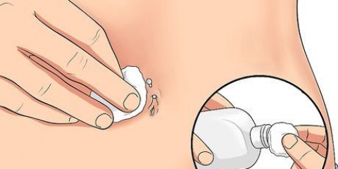Behandlar en irriterad navelpiercing