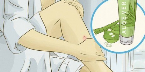 Behandla en keloid