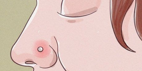 Behandling av en inflammerad näspiercing