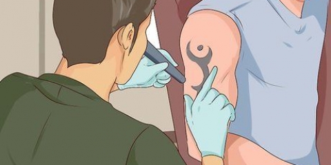 Ta bort en tatuering