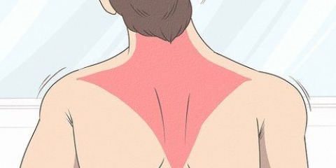 Återställa en trapezius-stam