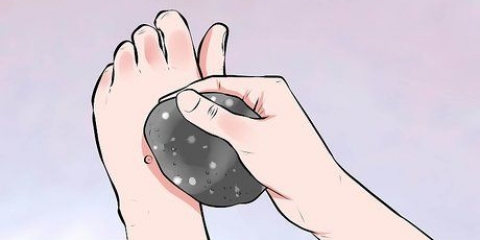Behandla en vårta hemma