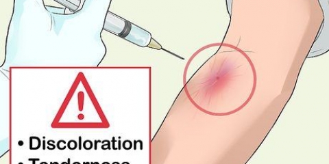 Upptäck när en av dina artärer har kollapsat
