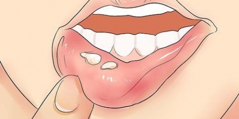 Känner igen herpes